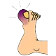 وارم